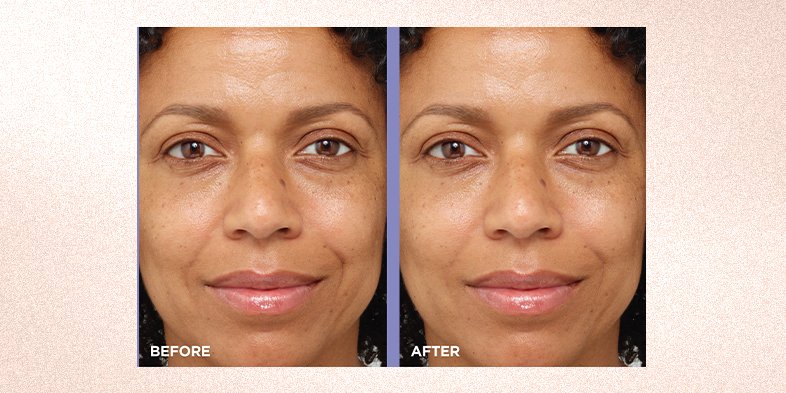 In Article How To Get Clear Skin RevitaLift Line Plumping Water Cream